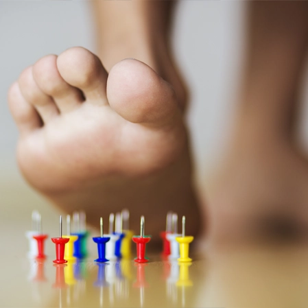 Neuropathy Foot Pain